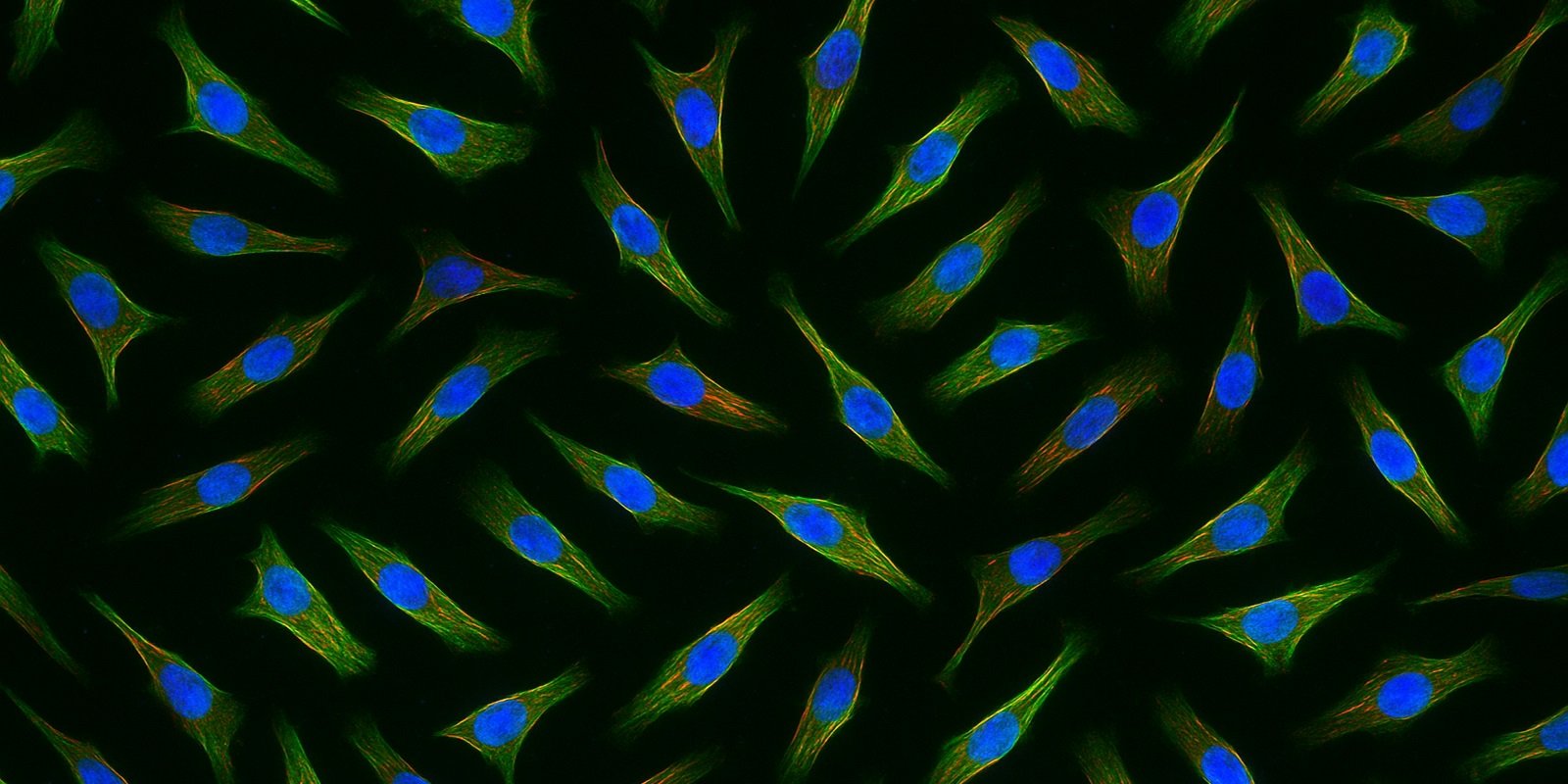 Differentiated cell 3