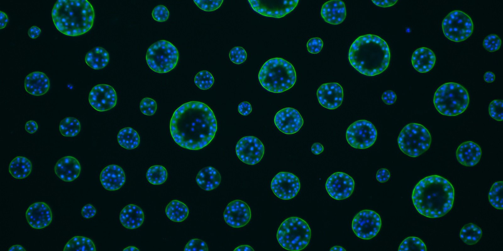 Organoid 3